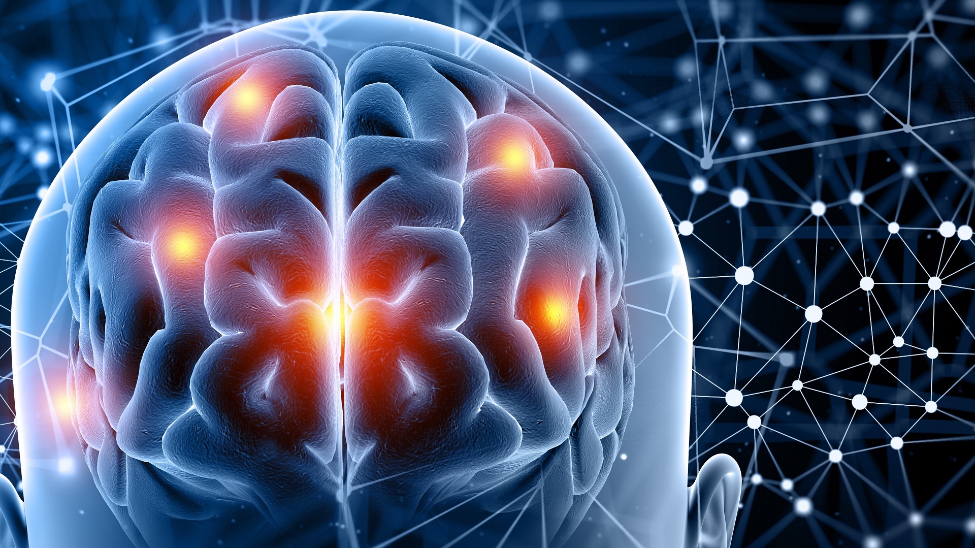 Alteplase na Janela Estendida para AVC Isquêmico de Circulação Posterior: Um Novo Horizonte Terapêutico?